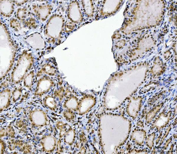 CUX1 Rabbit Polyclonal Antibody