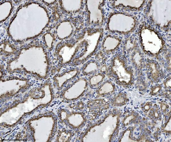 SCA2/ATXN2 Rabbit Polyclonal Antibody