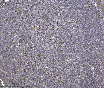 SCA2/ATXN2 Rabbit Polyclonal Antibody