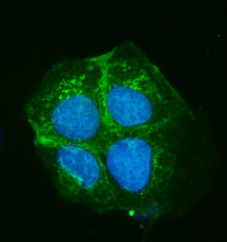 ATP7B Rabbit Polyclonal Antibody