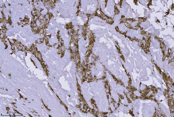 Annexin-4/ANXA4 Rabbit Polyclonal Antibody