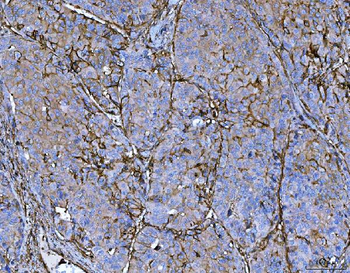 P Glycoprotein/ABCB1 Rabbit Polyclonal Antibody