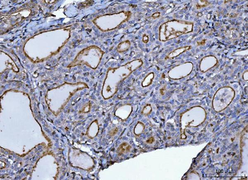 P Glycoprotein/ABCB1 Rabbit Polyclonal Antibody
