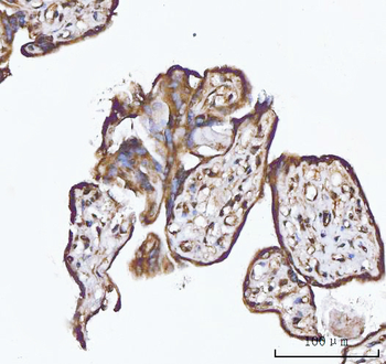 XAF1 Rabbit Polyclonal Antibody