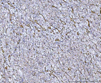 Von Willebrand Factor/VWF Rabbit Polyclonal Antibody
