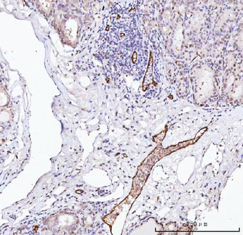 Von Willebrand Factor/VWF Rabbit Polyclonal Antibody