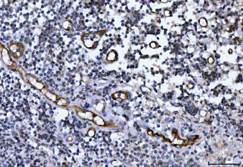 Von Willebrand Factor/VWF Rabbit Polyclonal Antibody