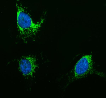 TOMM20 Rabbit Polyclonal Antibody