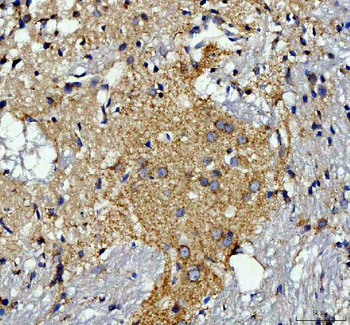 TOMM20 Rabbit Polyclonal Antibody