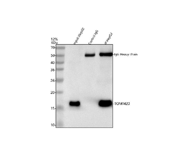 TOMM20 Rabbit Polyclonal Antibody