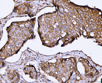 SNAP23 Rabbit Polyclonal Antibody