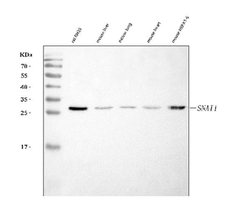 SNAIL/SNAI1 Rabbit Polyclonal Antibody