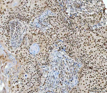 RING2/RING1B/RNF2 Rabbit Polyclonal Antibody