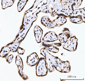 RING2/RING1B/RNF2 Rabbit Polyclonal Antibody