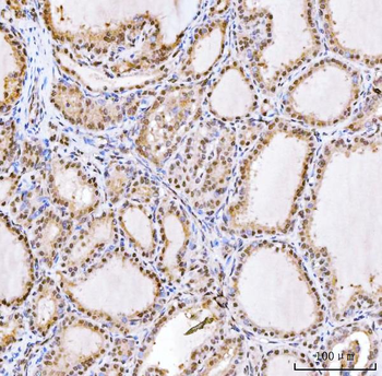 RING2/RING1B/RNF2 Rabbit Polyclonal Antibody