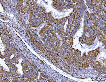 MIM/MTSS1 Rabbit Polyclonal Antibody