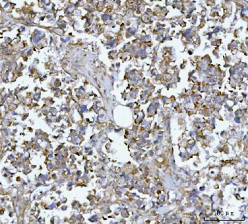 MIM/MTSS1 Rabbit Polyclonal Antibody