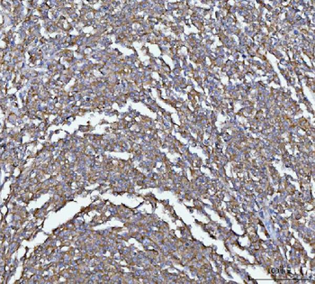 MIM/MTSS1 Rabbit Polyclonal Antibody