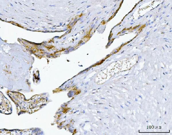 MIM/MTSS1 Rabbit Polyclonal Antibody