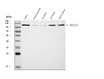 MIM/MTSS1 Rabbit Polyclonal Antibody
