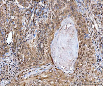 MRE11 Rabbit Polyclonal Antibody