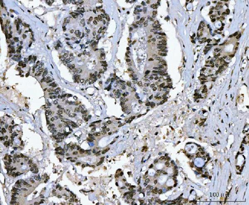 Ki67/MKI67 Rabbit Polyclonal Antibody