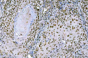 Ki67/MKI67 Rabbit Polyclonal Antibody