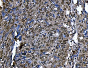 Ki67/MKI67 Rabbit Polyclonal Antibody