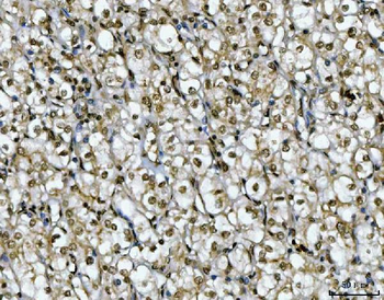 Ki67/MKI67 Rabbit Polyclonal Antibody