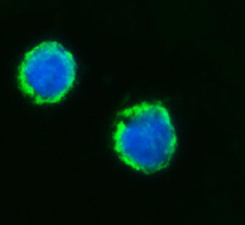 MFF Rabbit Polyclonal Antibody