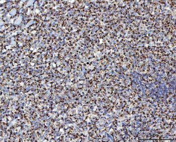 MFF Rabbit Polyclonal Antibody