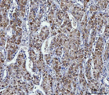 KMO Rabbit Polyclonal Antibody