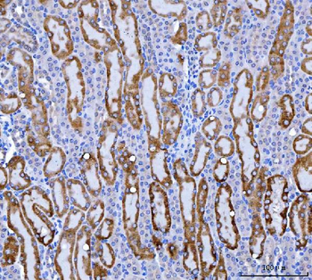 KMO Rabbit Polyclonal Antibody