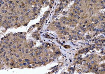 GOLGA3 Rabbit Polyclonal Antibody