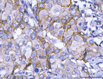 HER2/ERBB2 Rabbit Polyclonal Antibody