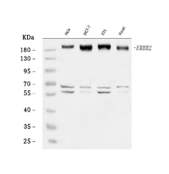 HER2/ERBB2 Rabbit Polyclonal Antibody