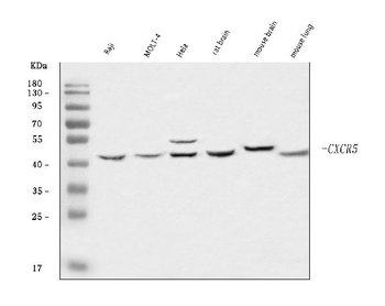 CXCR5 Rabbit Polyclonal Antibody