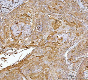 CRABP2 Rabbit Polyclonal Antibody