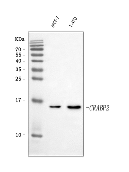 CRABP2 Rabbit Polyclonal Antibody