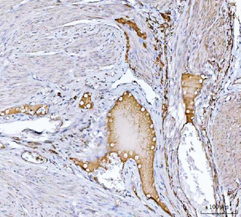 Clusterin/CLU Rabbit Polyclonal Antibody