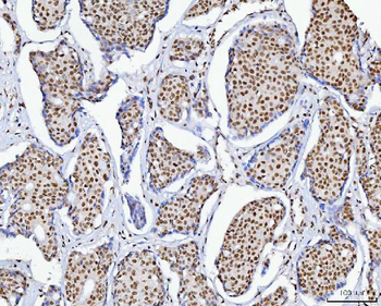 C1orf77/FOP/CHTOP Rabbit Polyclonal Antibody