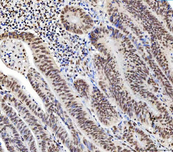 C1orf77/FOP/CHTOP Rabbit Polyclonal Antibody