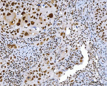 C1orf77/FOP/CHTOP Rabbit Polyclonal Antibody