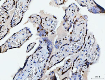 C1orf77/FOP/CHTOP Rabbit Polyclonal Antibody