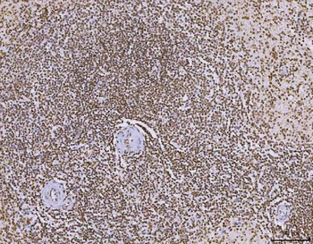 C1orf77/FOP/CHTOP Rabbit Polyclonal Antibody