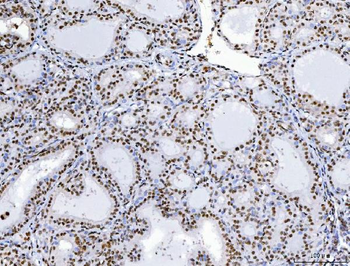 C1orf77/FOP/CHTOP Rabbit Polyclonal Antibody