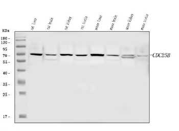 CDC25B Rabbit Polyclonal Antibody