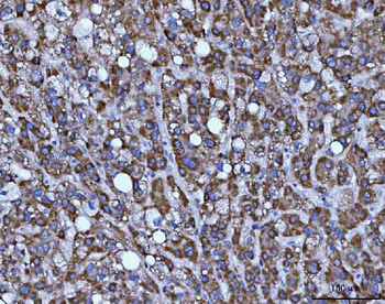 BBS9 Rabbit Polyclonal Antibody