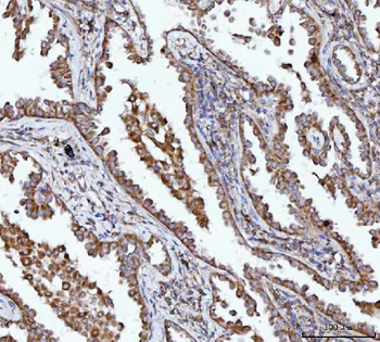 BBS9 Rabbit Polyclonal Antibody