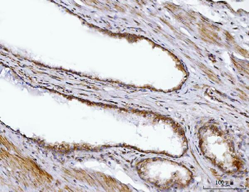 BBS9 Rabbit Polyclonal Antibody